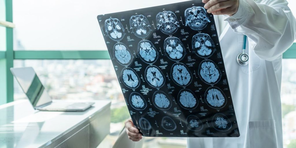 FDA advisers vote in favor of Biogen and Eisai’s collaborative Alzheimer’s treatment